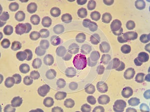 Malaria parasite photo