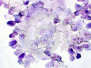 Malassezia yeast cytology of human epidermis