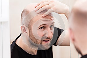 Calvo uomo cercando Specchio sul Testa calvizie un capelli perdita 