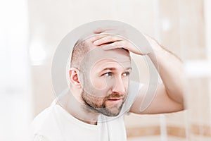 Bald man looking mirror at head baldness and hair loss
