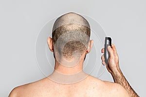 Male alopecia. A man with a receding hairline is holding an electric razor. Rear view. Shoulder-length view. Gray background. Copy