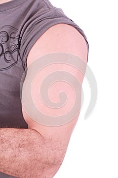 The male arm