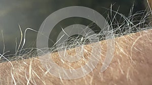 Male arm hairs that rise attracted by electrostatic energy - emotional moments
