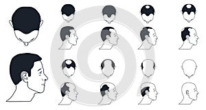 Male baldness icons