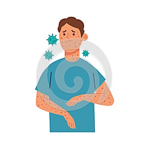 male character with monkeypox virus