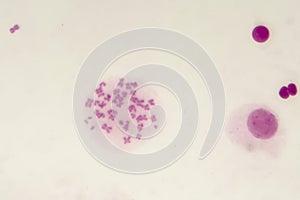 Male chromosomes inside the cell photo