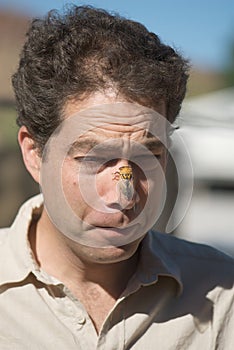 Male with Cicada bug on face