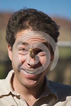 Male with Cicada bug on face