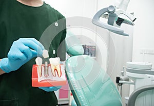 Male dentist carrying a sample of dental implants