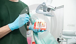 Male dentist carrying a sample of dental implants