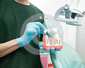 Male dentist carrying a sample of dental implants