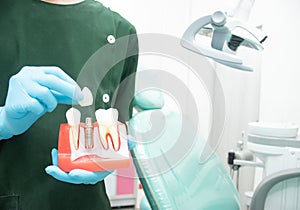 Male dentist carrying a sample of dental implants