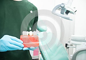 Male dentist carrying a sample of dental implants