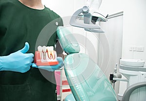 Male dentist carrying a sample of dental implants