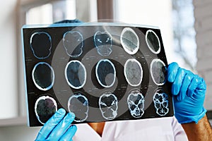 Male doctor examines MRI brain scan of a patient