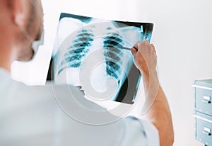 Male doctor examining the patient chest x-ray film lungs scan at radiology department in hospital.Covid-19 scan body xray test