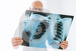 Male doctor examining the patient chest x-ray film lungs scan at radiology department in hospital.Covid-19 scan body xray test