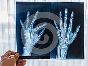 Male doctor holding film medical x-ray both hand
