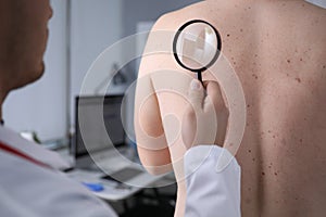 Male doctor look at magnifying glass on patient skin