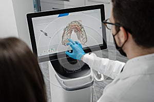 Male doctor show results of digital intraoral scan of patient teeth in 3D on display.