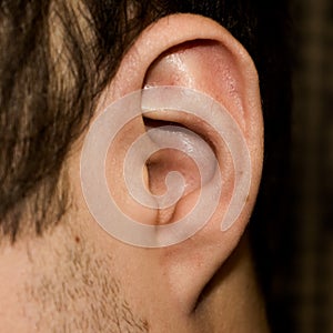 Male ear. Adherent earlobe close-up.