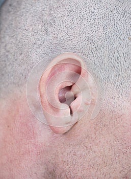 Male ear