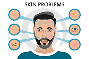 Male face skin problems. Acne and pimples, black spots, redness, dryness, circles under the eyes and wrinkles. Vector.