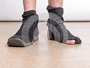 Male feet with sock in hole