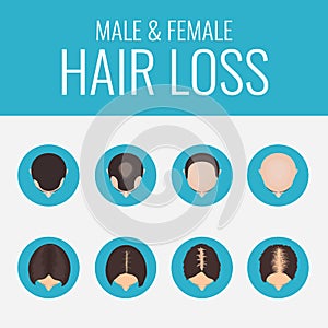 Male and female hair loss set