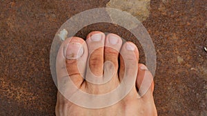 Male Foot with second toe longer than a big toe. Mortons`s toe, Greek foot or Royal toe or Aboriginal feet. photo
