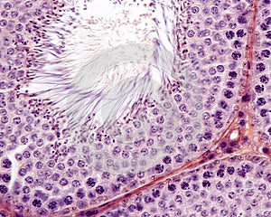 Male germinal epithelium. Spermatogenesis photo