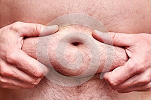 Male hands hold subcutaneous fat on the hairy belly