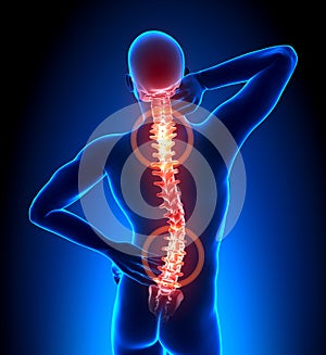 Male Hurt Backbone - Vertebrae Pain