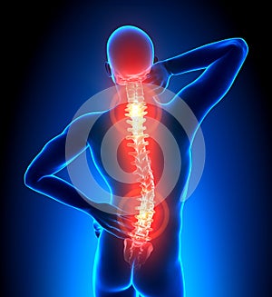 Male Hurt Backbone - Vertebrae Pain