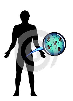 Male infertility