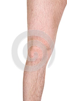Male knee