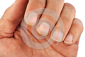 Male left hand fingers with dirt under the nails, closeup macro, isolated