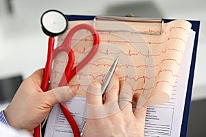 Male medicine doctor hands holding cardiogram chart