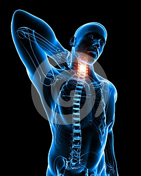 Male neck pain