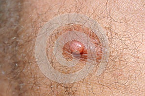 Male nipple photo