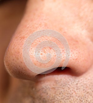 Male nose. close
