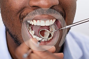 Male Patient Being Checked By Dentist
