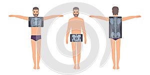 Male patient and his chest, pelvis and back radiograph isolated on white background. Bearded man and X-ray pictures of