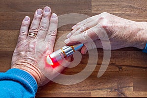 Male patient is treating himself on his hand with red light from a soft laser for health application. A warning label danger is at