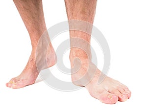 Male person with hairy legs