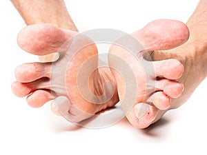 Male person spreading toes