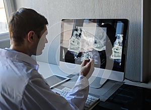 Male radiologist examining a x-ray that he is holding in his hands