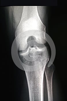 Male Right Knee - Bent