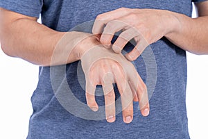 Male scratching his hand isolated white background. Medical, healthcare for advertising concept photo