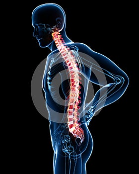 Male spine pain anatomy in blue